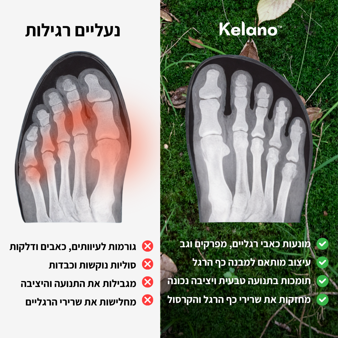 ™FrostStep - נוחות יומיומית ללא כאבים בחורף